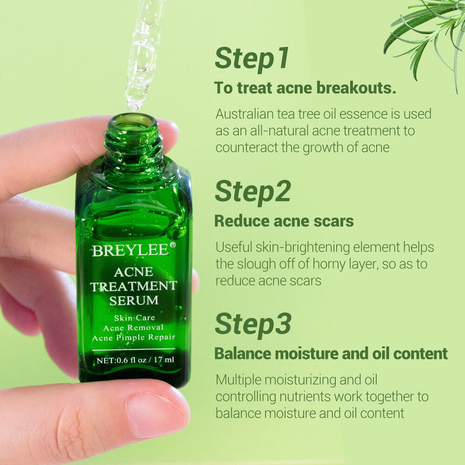 BREYLEE Acne Treatment Face Serum Mask Anti Acne Pimple Scar Remover Moisturizing Whitening Skin Care Facial Essence Cream 17ml